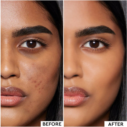 COVER &amp; CONCEAL 12-1 DERMA PALETTE (METAL)