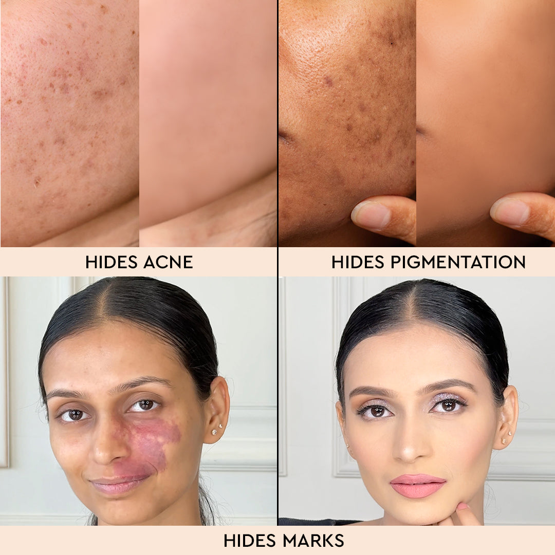 COVER &amp; CONCEAL 6-1 ULTRA HD DERMA PALETTE (Metal)